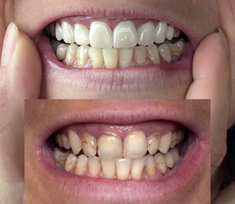 Only Crowns — Professional Services in St. George, UT
