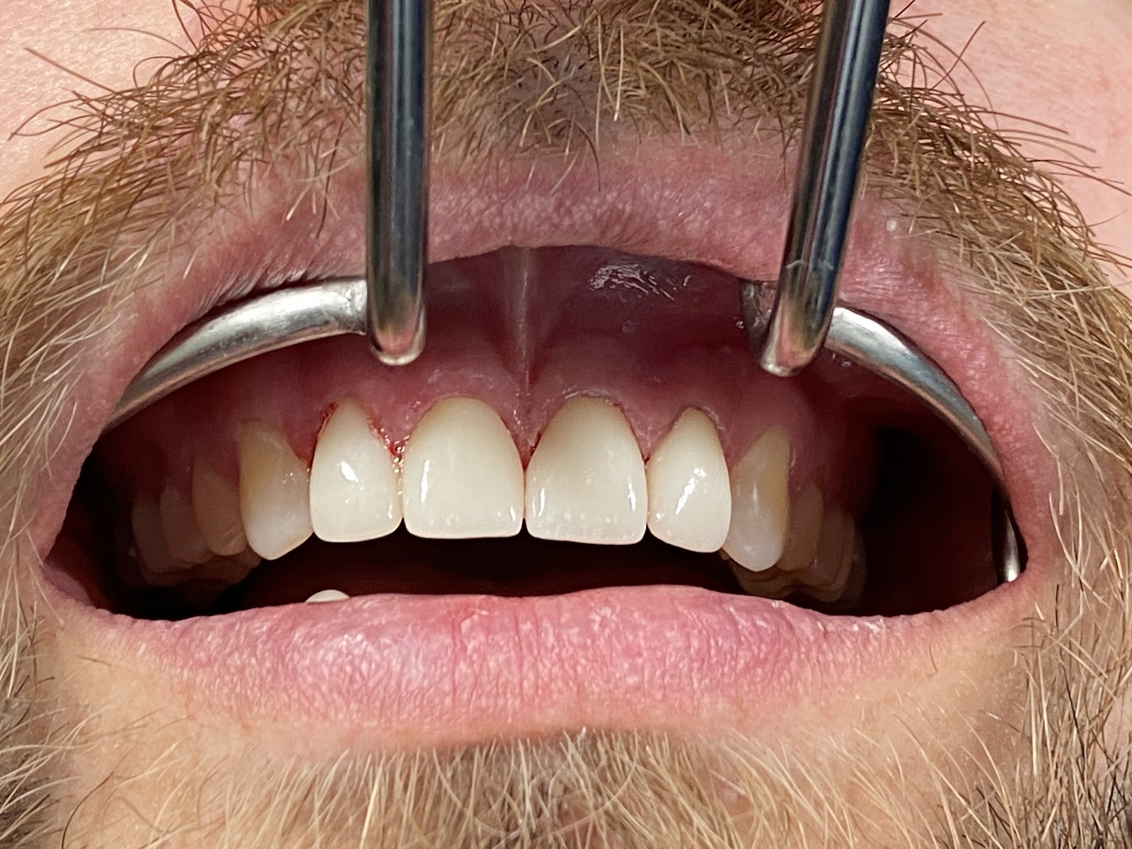 Avenues Dentistry
